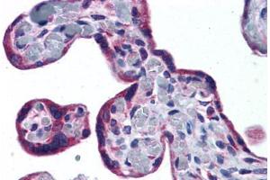 Human Placenta: Formalin-Fixed, Paraffin-Embedded (FFPE) (PTH1R antibody  (AA 145-194))