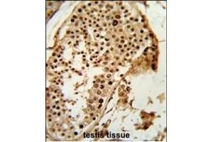 Formalin-fixed and raffin-embedded human testis tissue reacted with RD3 Antibody (C-term), which was peroxidase-conjugated to the secondary antibody, followed by DAB staining. (PARD3 antibody  (C-Term))