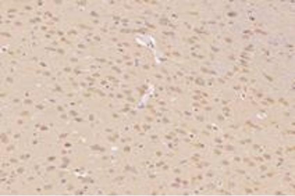 TTL antibody