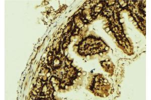 Immunohistochemistry (IHC) image for anti-Epidermal Growth Factor Receptor (EGFR) (pTyr1016) antibody (ABIN6256611)