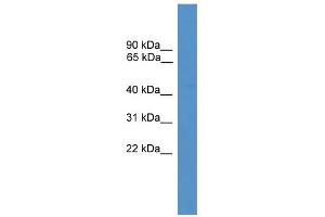 WB Suggested Anti-NPFFR2 Antibody Titration: 0. (NPFFR2 antibody  (Middle Region))