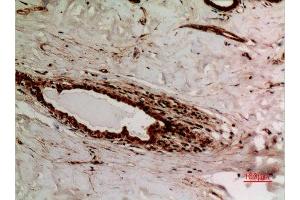Immunohistochemistry (IHC) image for anti-X-Ray Repair Complementing Defective Repair in Chinese Hamster Cells 6 (XRCC6) (acLys539) antibody (ABIN3181889)