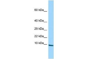 Host: Rabbit Target Name: PLGLB1 Sample Type: Jurkat Whole Cell lysates Antibody Dilution: 1. (PLGLB1 antibody  (Middle Region))