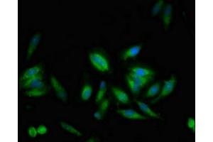 Immunofluorescent analysis of Hela cells using ABIN7174250 at dilution of 1:100 and Alexa Fluor 488-congugated AffiniPure Goat Anti-Rabbit IgG(H+L) (USP1 antibody  (AA 453-592))