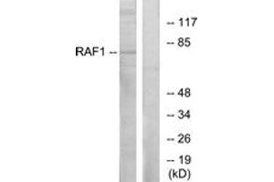 Western Blotting (WB) image for anti-V-Raf-1 Murine Leukemia Viral Oncogene Homolog 1 (RAF1) (AA 311-360) antibody (ABIN2888699) (RAF1 antibody  (AA 311-360))
