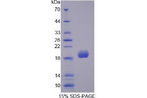 Image no. 1 for Superoxide Dismutase 3, Extracellular (SOD3) (AA 25-166) protein (His tag) (ABIN6236598)