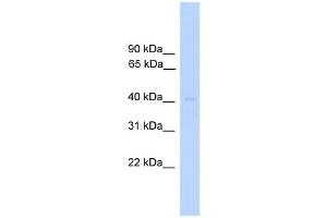 WB Suggested Anti-DUSP5 Antibody Titration: 0. (DUSP5 antibody  (Middle Region))