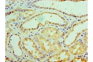 Immunohistochemistry (IHC) image for anti-UDP-Galactose-4-Epimerase (GALE) (AA 1-348) antibody (ABIN7174611)