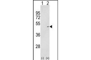 Western blot analysis of P2K2 (arrow) using rabbit polyclonal P2K2- (ABIN1881526 and ABIN2842063). (MEK2 antibody  (AA 200-229))