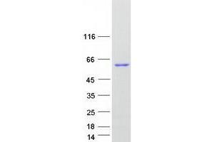 Validation with Western Blot