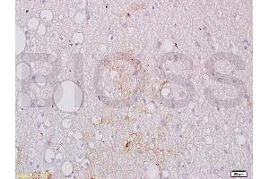Formalin-fixed and paraffin embedded human brain tissue labeled with Anti-GPIIb Polyclonal Antibody, Unconjugated (ABIN748358) at 1:200 followed by conjugation to the secondary antibody, (SP-0023), and DAB staining