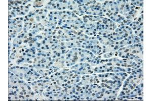 Immunohistochemical staining of paraffin-embedded pancreas tissue using anti-TYRO3mouse monoclonal antibody. (TYRO3 antibody)