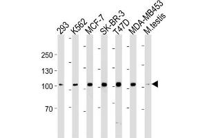 Western Blotting (WB) image for anti-Angiotensin I Converting Enzyme 2 (ACE2) antibody (ABIN3004589) (ACE2 antibody)