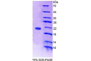 SDS-PAGE analysis of Human WTAP Protein.