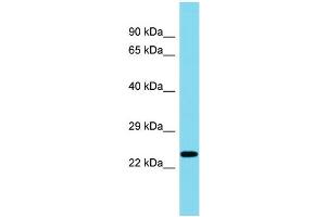 Host: Rabbit Target Name: C8orf46 Sample Type: Fetal Liver lysates Antibody Dilution: 1. (C8ORF46 antibody  (C-Term))