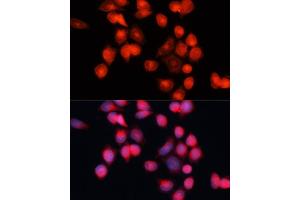 Immunofluorescence analysis of HeLa cells using SLC25 antibody (ABIN7270430) at dilution of 1:100 (40x lens). (SLC25A5 antibody  (AA 150-250))