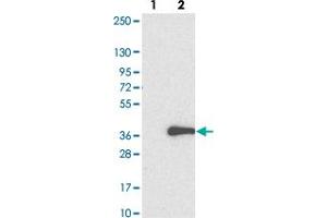 Western blot analysis of Lane 1: Negative control (vector only transfected HEK293T lysate). (ADO antibody)