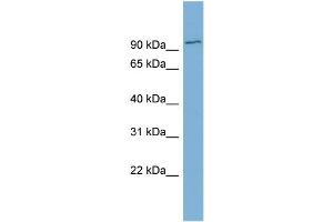WB Suggested Anti-FBXO34  Antibody Titration: 0.