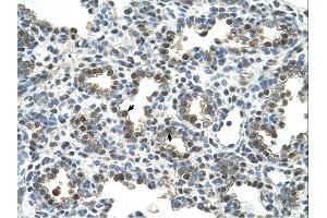 Immunohistochemistry (IHC) image for anti-Osteoactivin (GPNMB) (N-Term) antibody (ABIN310605) (Osteoactivin antibody  (N-Term))