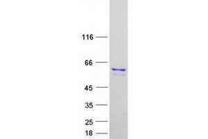 Validation with Western Blot (TRF1 Protein (Transcript Variant 2) (Myc-DYKDDDDK Tag))