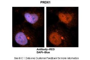 Researcher: Dr. (Peroxiredoxin 1 antibody  (N-Term))