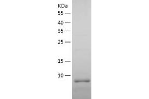 APOC1 Protein (AA 27-83) (His tag)