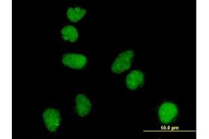 Immunofluorescence of monoclonal antibody to ATR on HeLa cell. (ATR antibody  (AA 2545-2644))