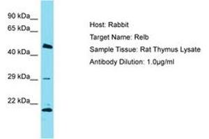 Image no. 1 for anti-V-Rel Reticuloendotheliosis Viral Oncogene Homolog B (RELB) (AA 380-429) antibody (ABIN6750252) (RELB antibody  (AA 380-429))