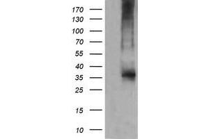 Western Blotting (WB) image for anti-T-cell surface glycoprotein CD1c (CD1C) antibody (ABIN2670659) (CD1c antibody)