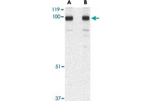 Western blot analysis of STIM2 in A-20 cell lysate with STIM2 polyclonal antibody  at (A) 0. (Stim2 antibody  (C-Term))