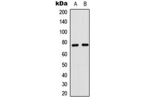 Western blot analysis of CD180 expression in human spleen (A), mouse brain (B) whole cell lysates. (CD180 antibody  (Center))