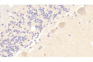 Detection of PLCb3 in Human Cerebellum Tissue using Polyclonal Antibody to Phospholipase C Beta 3, Phosphoinositide Specific (PLCb3) (Phospholipase C beta 3, Phosphoinositide Specific (AA 318-468) antibody)