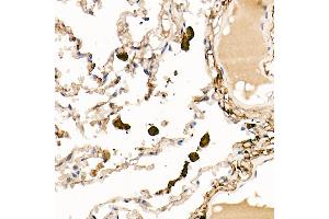 Immunohistochemistry of paraffin-embedded rat kidney using Ferritin Light Chain Rabbit pAb (ABIN6133515, ABIN6140791, ABIN6140792 and ABIN6218871) at dilution of 1:150 (40x lens). (FTL antibody  (AA 1-175))