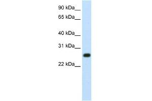 WB Suggested Anti-MINA Antibody Titration:  1. (MINA antibody  (N-Term))