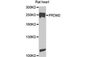 Western blot analysis of extracts of rat heart cells, using PRDM2 antibody. (PRDM2 antibody)