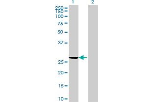 COG8 antibody  (AA 1-219)