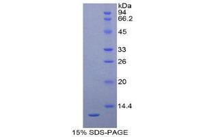 SDS-PAGE (SDS) image for Proteoglycan 4 (PRG4) (AA 1151-1241) protein (His tag) (ABIN2121969)