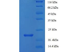 SDS-PAGE (SDS) image for phospholipase A2 Receptor 1, 180kDa (PLA2R1) (AA 395-530), (partial) protein (His tag) (ABIN4976256) (PLA2R1 Protein (AA 395-530, partial) (His tag))