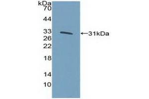 Western blot analysis of recombinant Human KLF5. (KLF5 antibody  (AA 216-457))