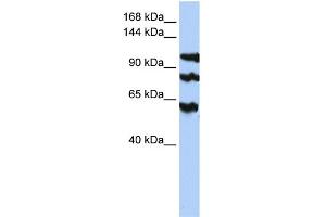 WB Suggested Anti-PPP1R13B Antibody Titration:  0. (PPP1R13B antibody  (Middle Region))