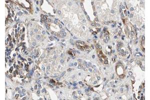 ABIN6267589 at 1/100 staining human kidney tissue sections by IHC-P. (RELB antibody  (pSer573))