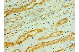 Immunohistochemistry of paraffin-embedded human kidney tissue using ABIN7146759 at dilution of 1:100 (CPA1 antibody  (AA 111-419))
