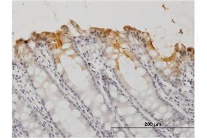 Immunoperoxidase of monoclonal antibody to CEACAM1 on formalin-fixed paraffin-embedded human colon. (CEACAM1 antibody  (AA 1-468))