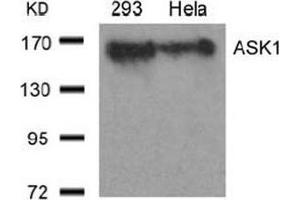 Image no. 3 for anti-Mitogen-Activated Protein Kinase Kinase Kinase 5 (MAP3K5) (Ser966) antibody (ABIN197326) (ASK1 antibody  (Ser966))