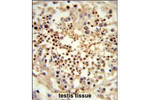 Formalin-fixed and paraffin-embedded human testis tissue reacted with UNC119 Antibody , which was peroxidase-conjugated to the secondary antibody, followed by DAB staining.