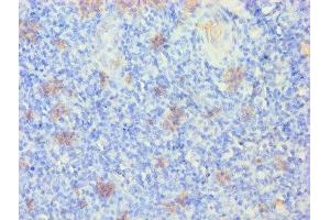 Immunohistochemistry of paraffin-embedded human tonsil tissue using ABIN7157384 at dilution of 1:100 (KRT14 antibody  (AA 1-472))