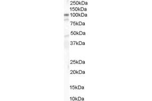 ABIN185626 (1µg/ml) staining of human colon lysate (35µg protein in RIPA buffer). (CTNNA1 antibody  (Internal Region))