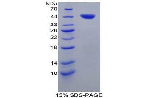 SDS-PAGE (SDS) image for Tryptase alpha/beta 1 (TPSAB1) (AA 151-275) protein (His tag,GST tag) (ABIN1879907)