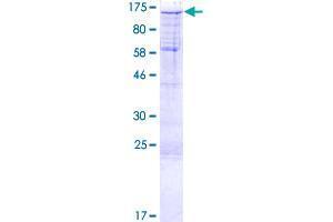 SSH1 Protein (AA 1-1049) (GST tag)