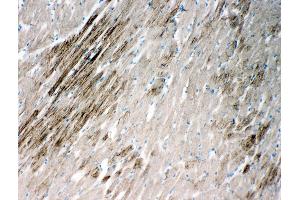 Anti-HSPB2 antibody, IHC(F) IHC(F): Rat Cardiac Muscle Tissue (HSPB2 antibody  (Middle Region))